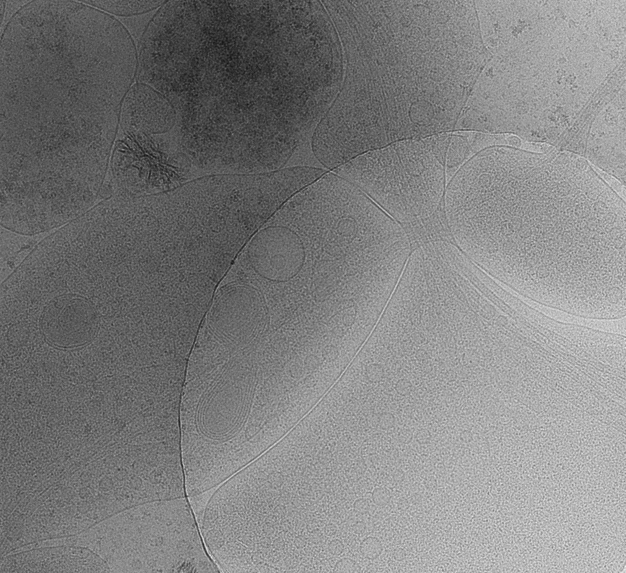In situ cryo-electron microscopy image