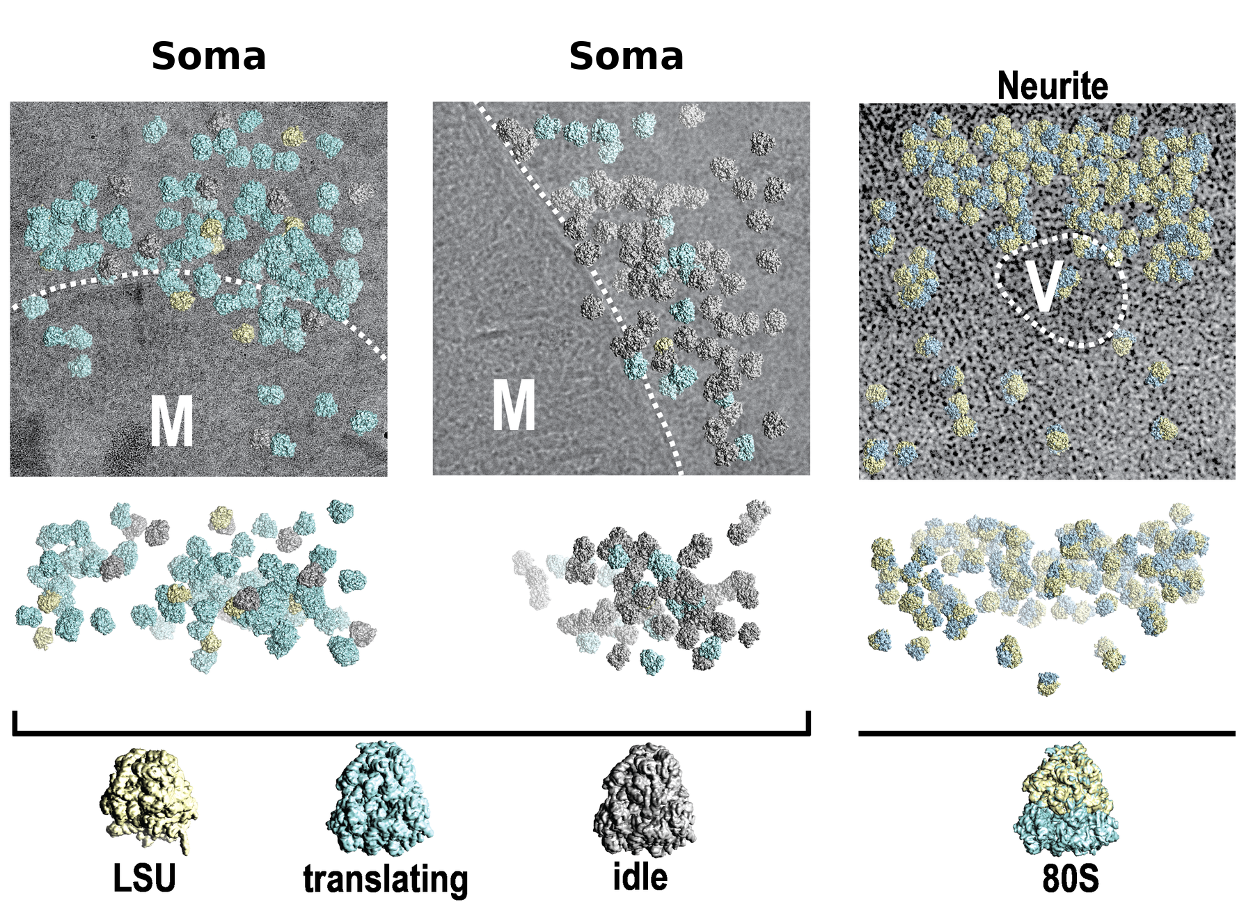 2D template matching examples showing ribosome-like particles mapped in cellular images